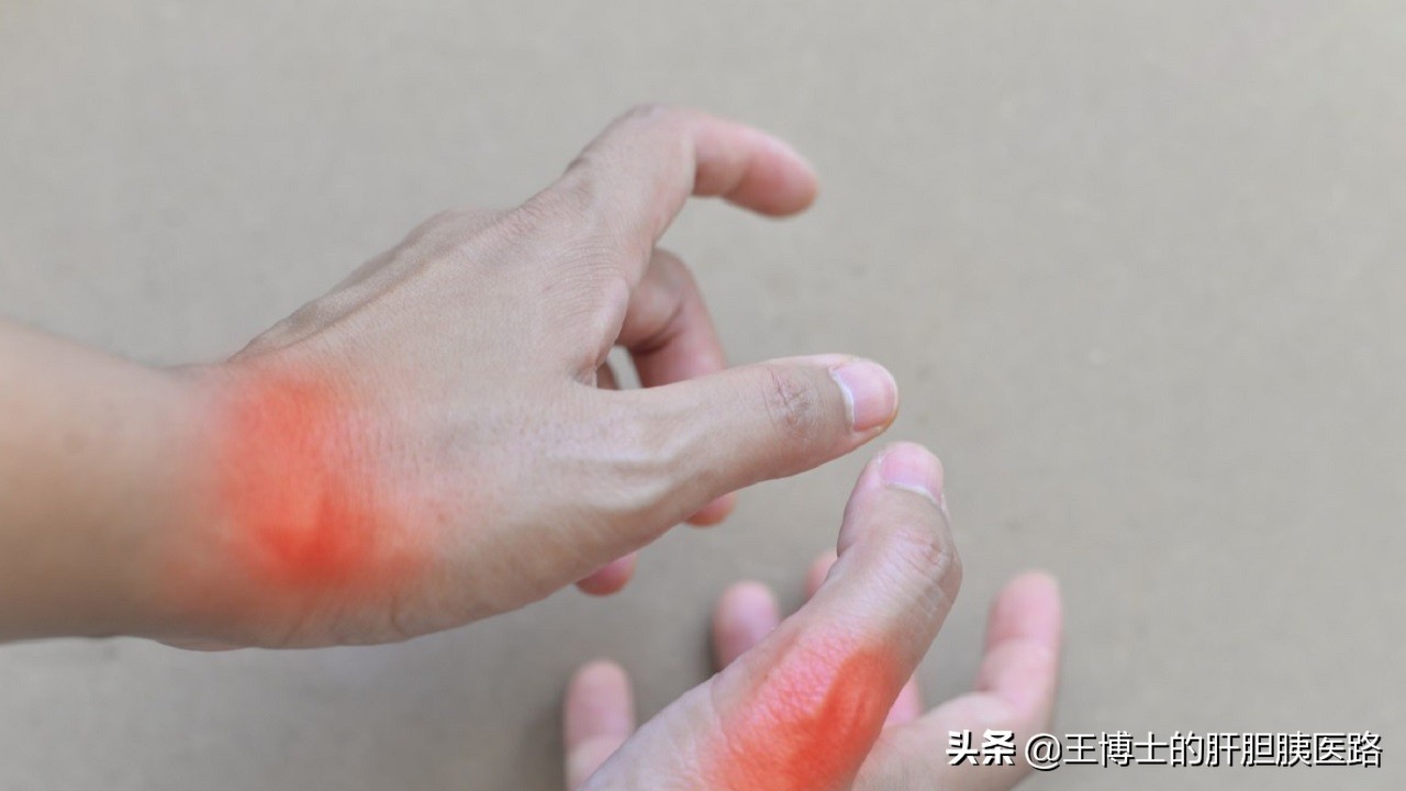 门诊大夫和手术大夫是同一个人嘛,门诊医生和住院医生哪个医术高