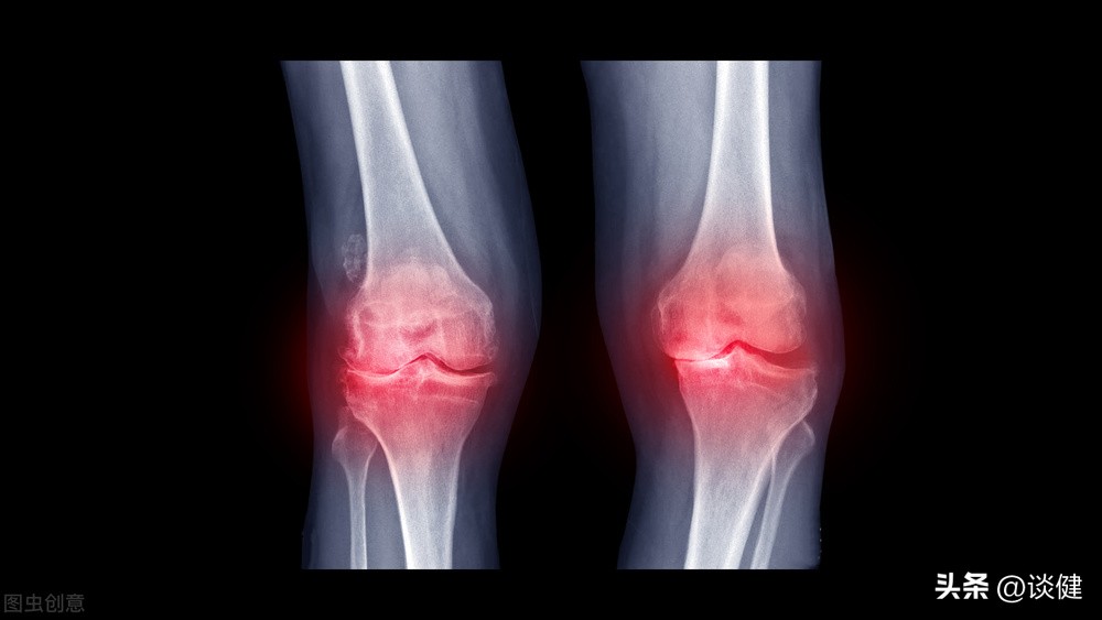 关节退化应该注意什么,关节退化的最好治疗方法