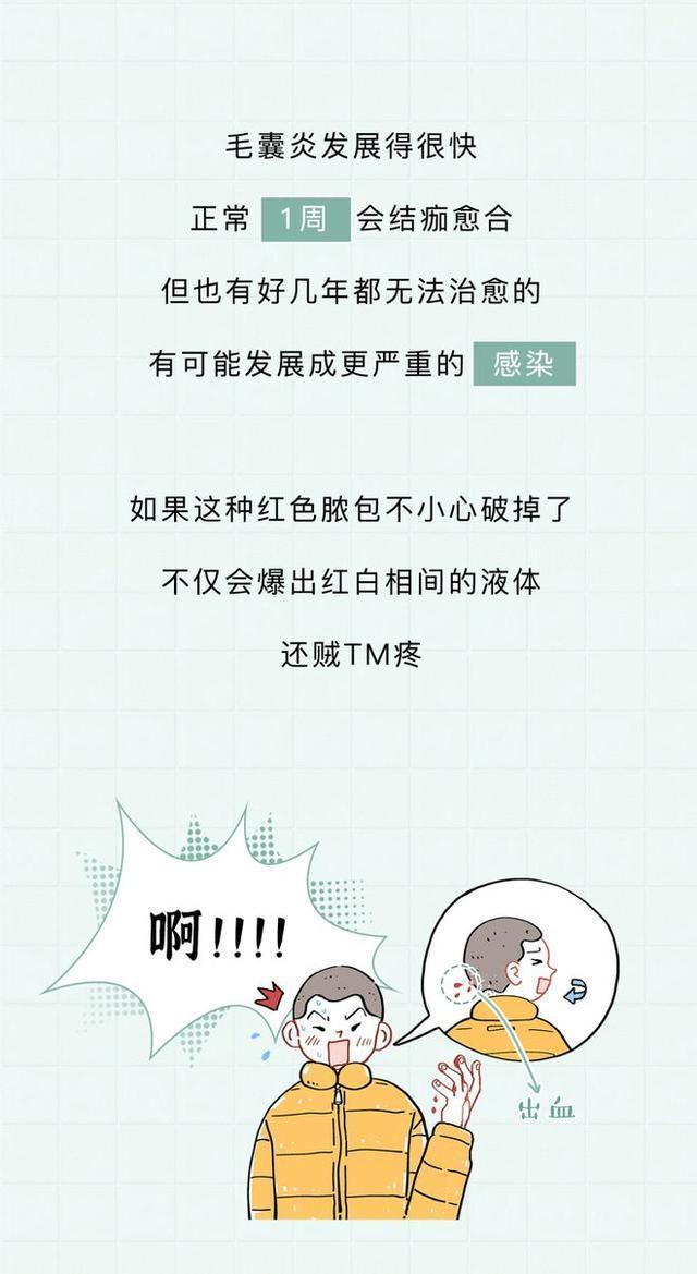 头皮内抠出白色颗粒状东西是什么,头皮上白色的小颗粒可以抠下来