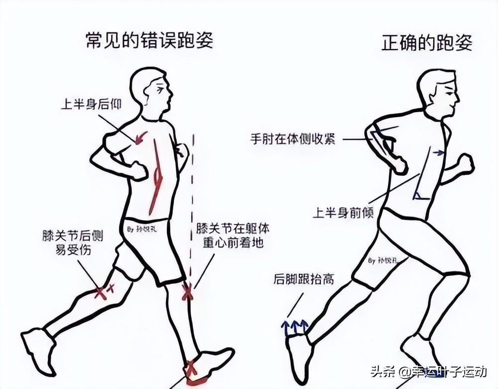 跑步膝盖痛的最快治疗方法,学会这几招跑步很轻松