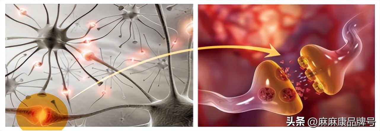 盆底肌电刺激与磁刺激的区别,什么是盆底磁刺激