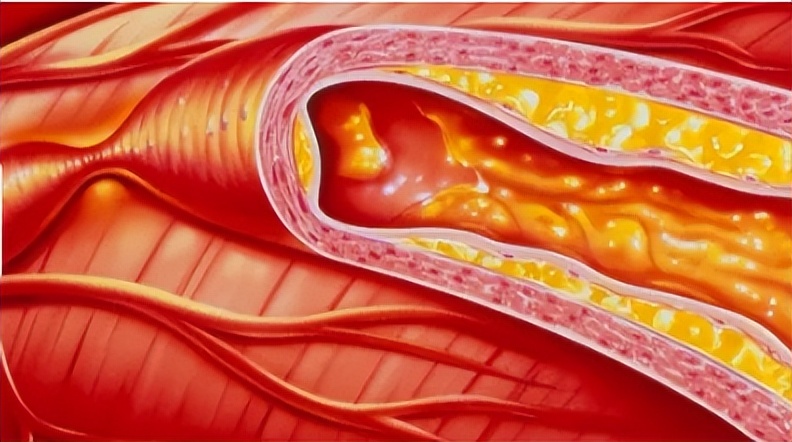 为什么肚子软如棉百病不缠身,腹部软如棉怎么治疗