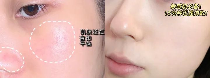 2021美白淡斑面膜十大排行榜口碑,祛痘印面膜真实测评有效第一名