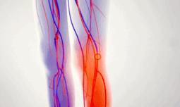 腿上起红肿大包疼,快告诉爸妈碰到这些人要当心