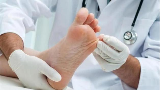 脚丫烂脚趾缝痒溃烂是怎么引起的,夏天脚趾缝烂是什么原因