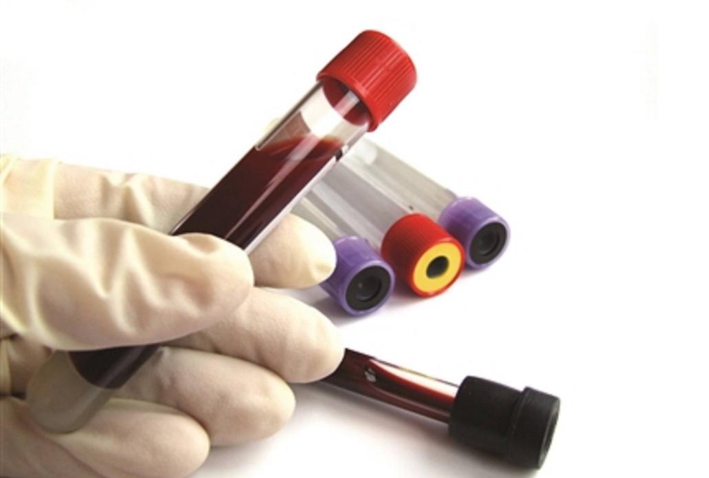 这些食物升糖快最好管住嘴,100种常见食物升糖指数快收藏