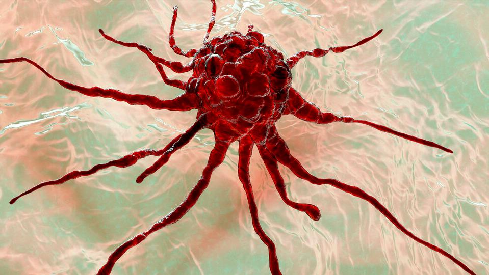 吃生大蒜抗癌真实性如何,生吃大蒜可以抗肿瘤吗