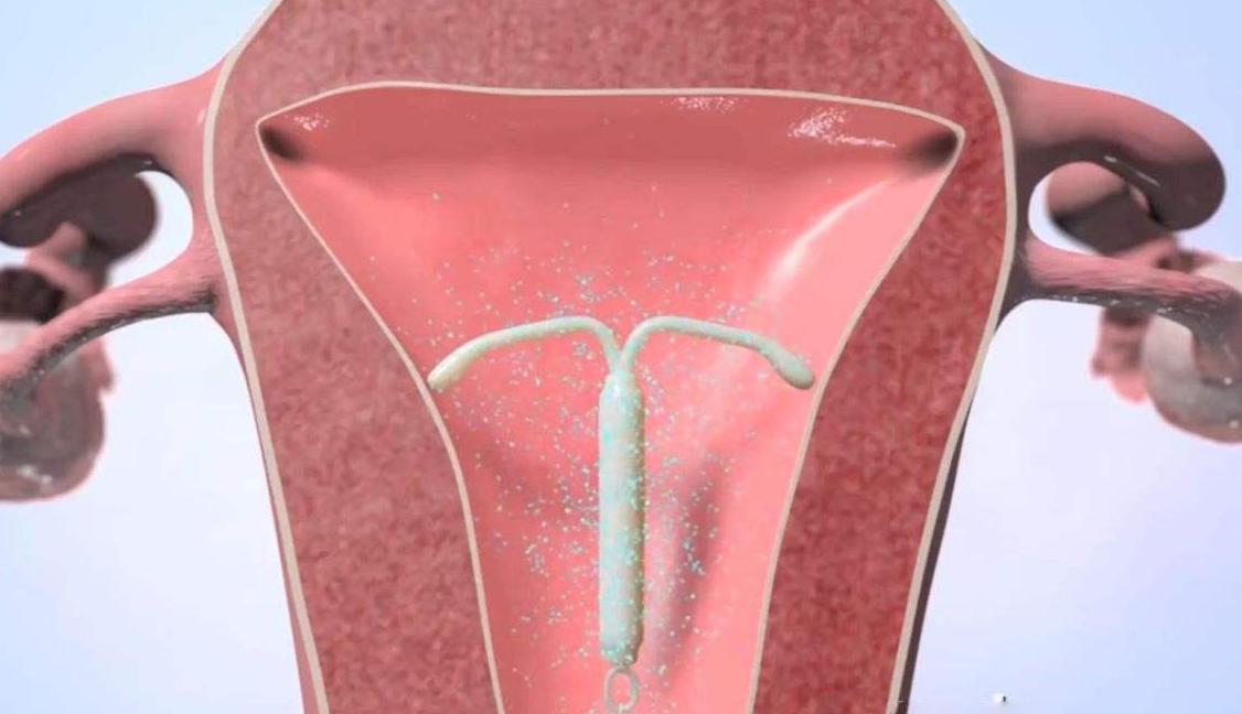 中国最初的避孕方法,古人没有保险套怎么避孕