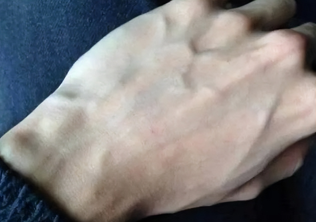 人手臂上的青筋看得出吗,手臂爆青筋是天生的吗