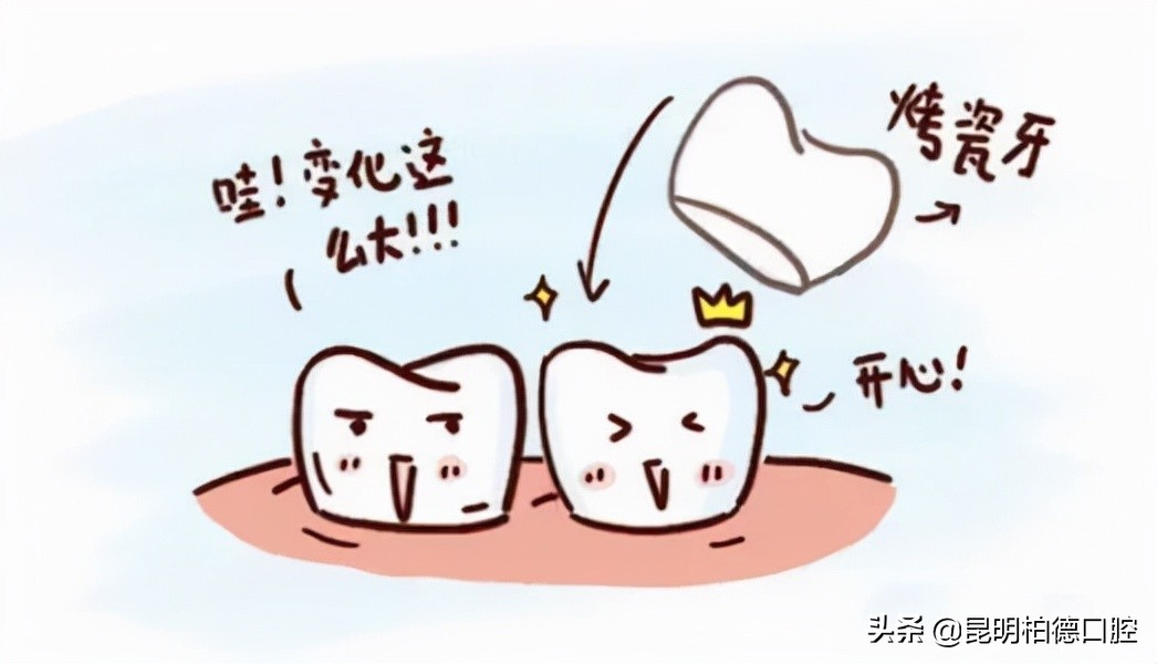 牙齿掉了一半做烤瓷牙全过程,关于牙齿烤瓷牙的一些小事情