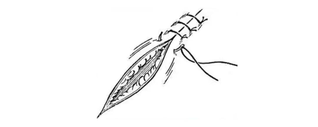 外科各种缝合方法的适用情况,外科操作缝合