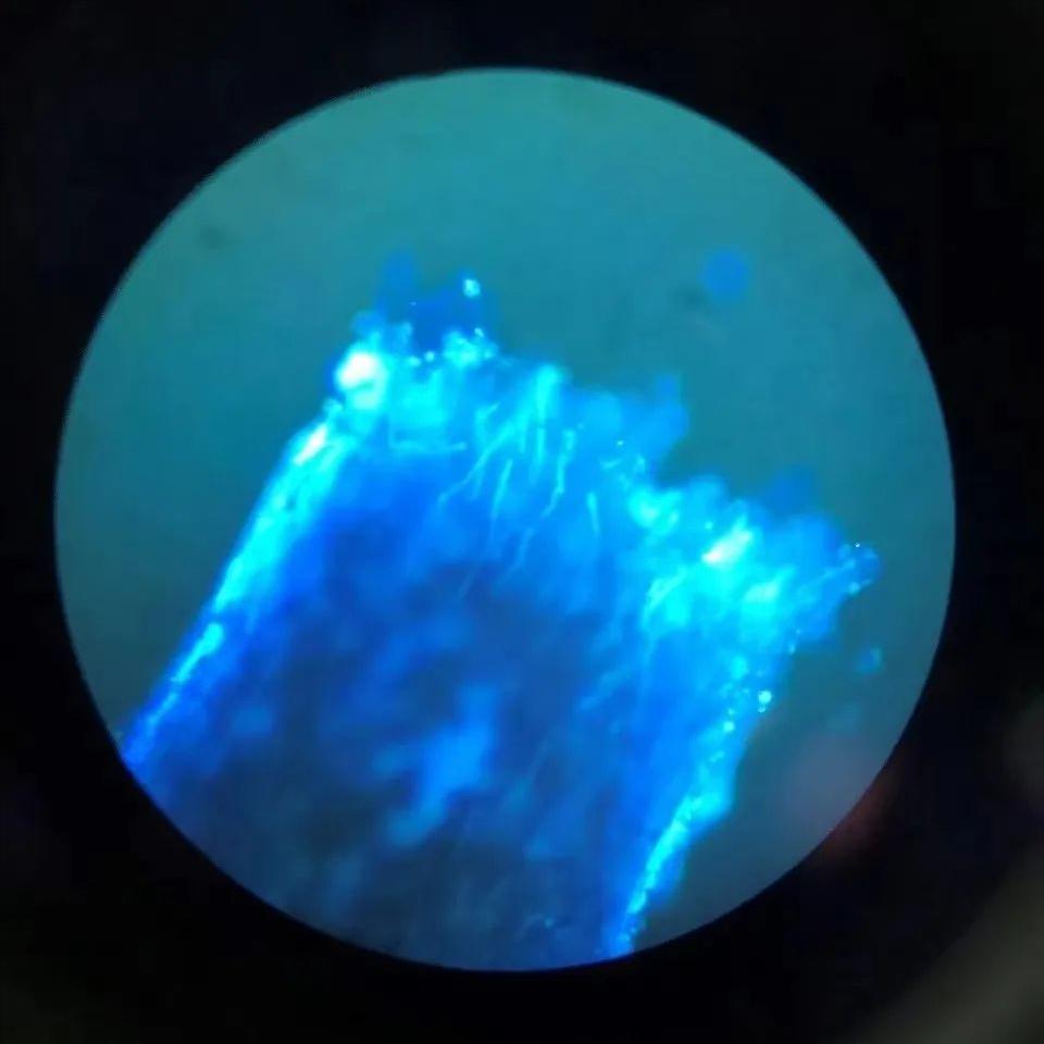 头屑多脱发怎么去除小妙招,头屑如何调理生发最有效