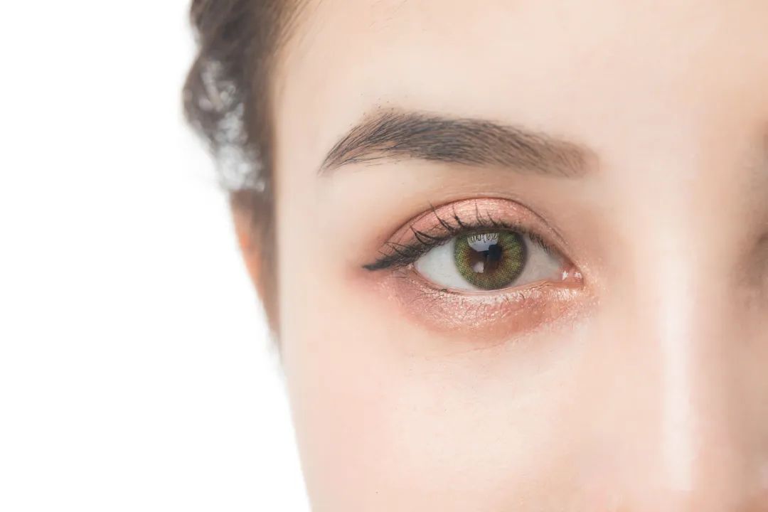 冯传波割双眼皮失败过吗,割双眼皮有褶子是失败了吗