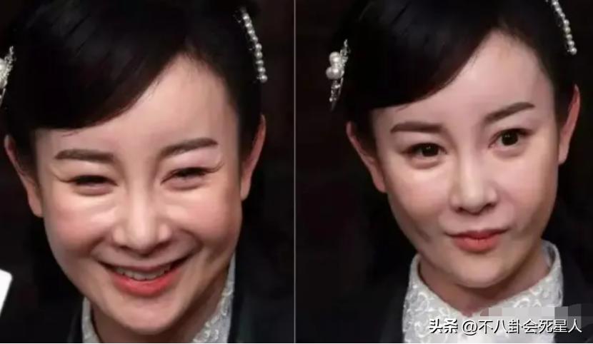 整容脸在现实中的样子,整容最好的脸有多好看