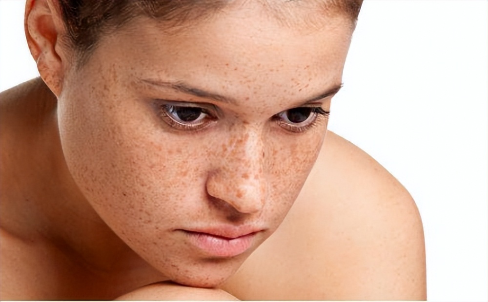 淡斑效果排名第一哪款口碑最好,维生素e哪个牌子好纯天然淡斑