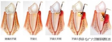 牙疼想知道自己是哪种牙疼,牙疼也算病一招解决绝对有效