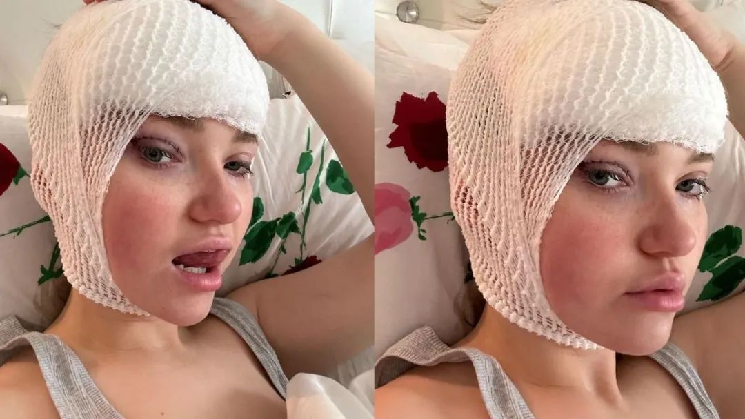 卡戴珊身体整形,卡戴珊做了哪些整容手术