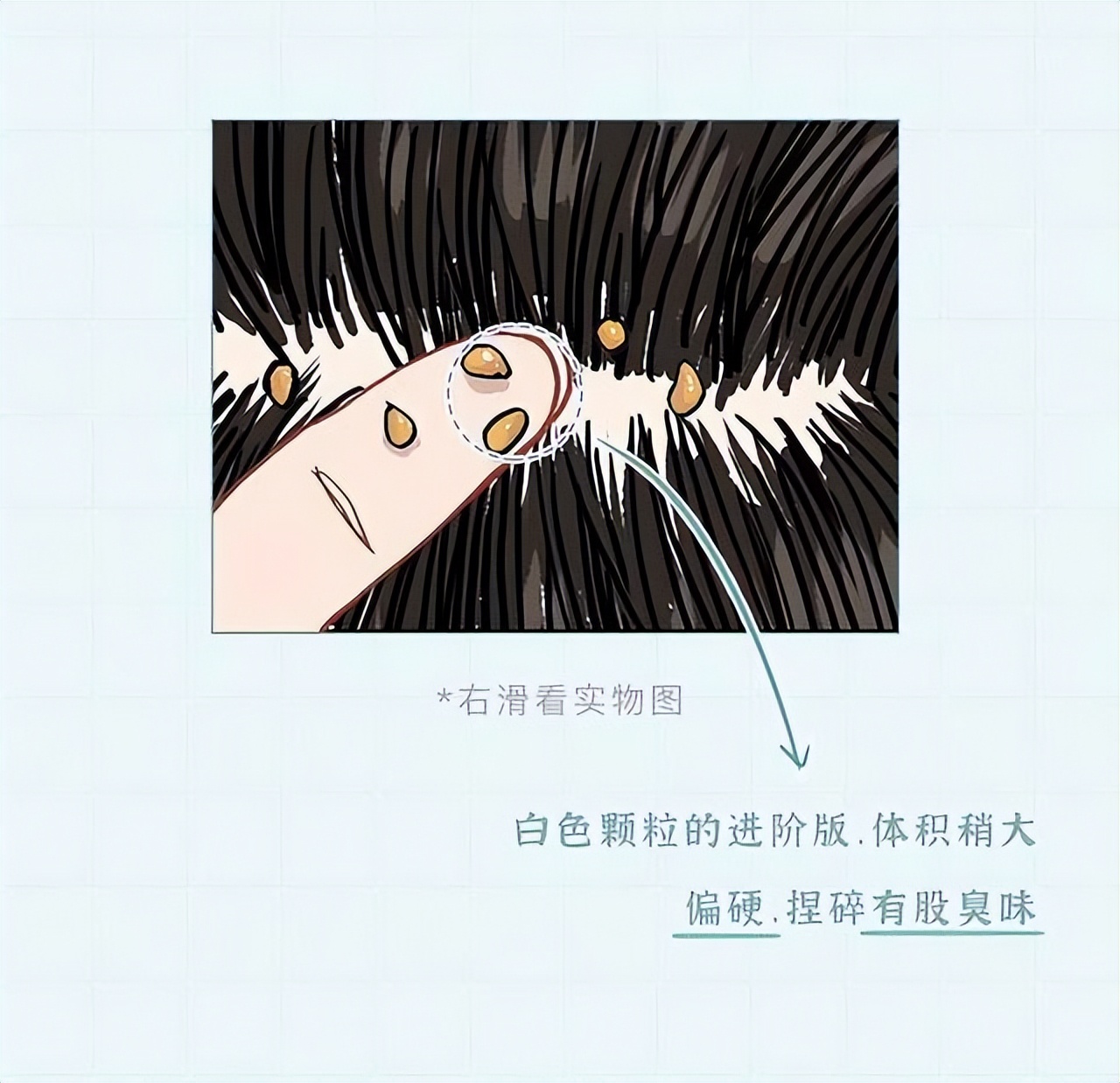 头皮上白色的颗粒是什么问题,头皮屑多是什么原因漫画