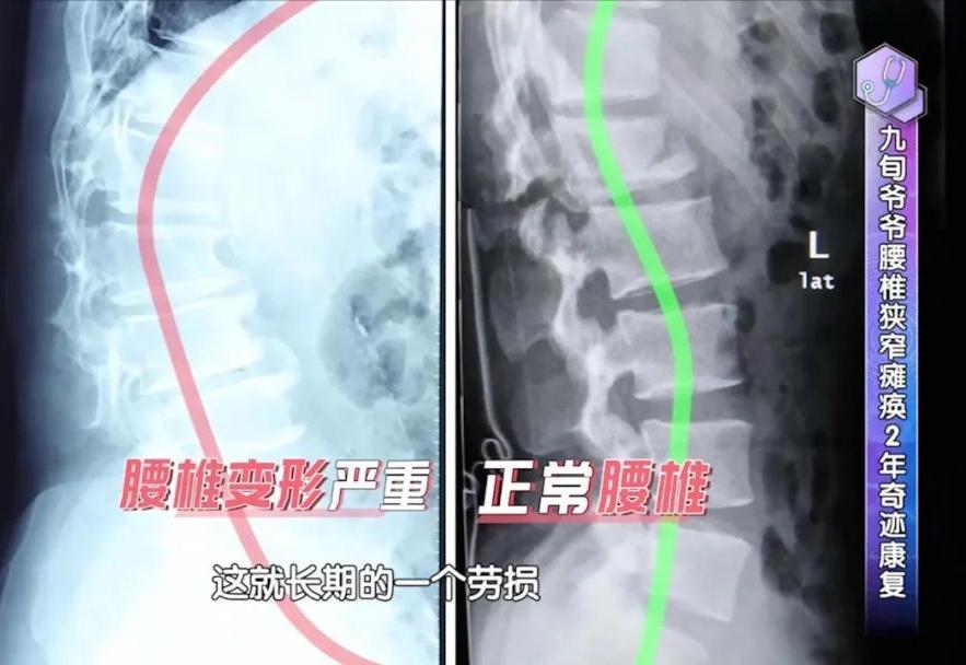 教你九招护腰秘诀,国家级老中医养腰秘诀