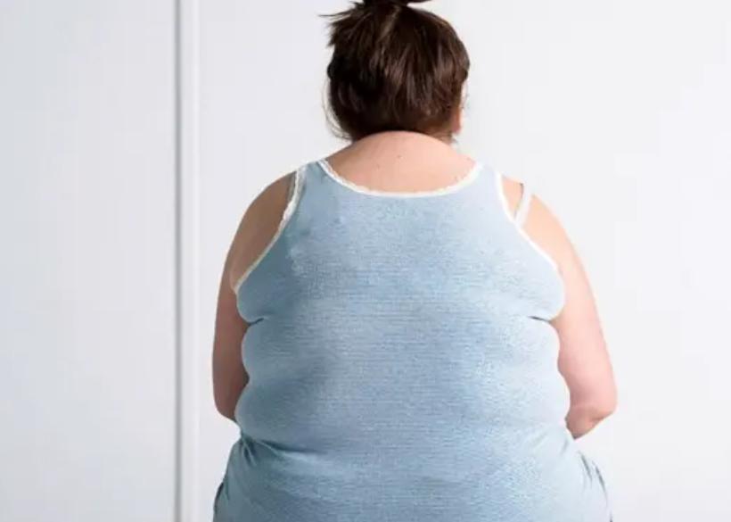 女子因抽脂手术感染身亡,女子抽脂感染去世