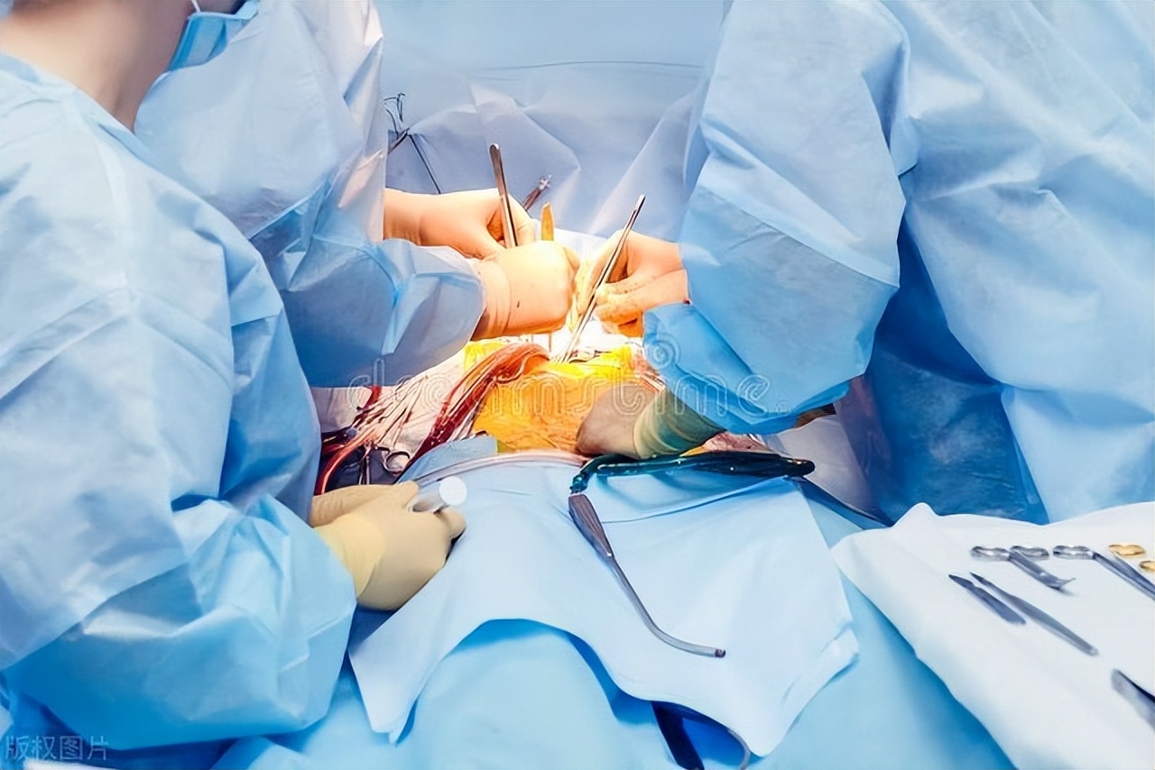 冠心病放支架好还是药物治好,冠心病是放支架还是保守治疗