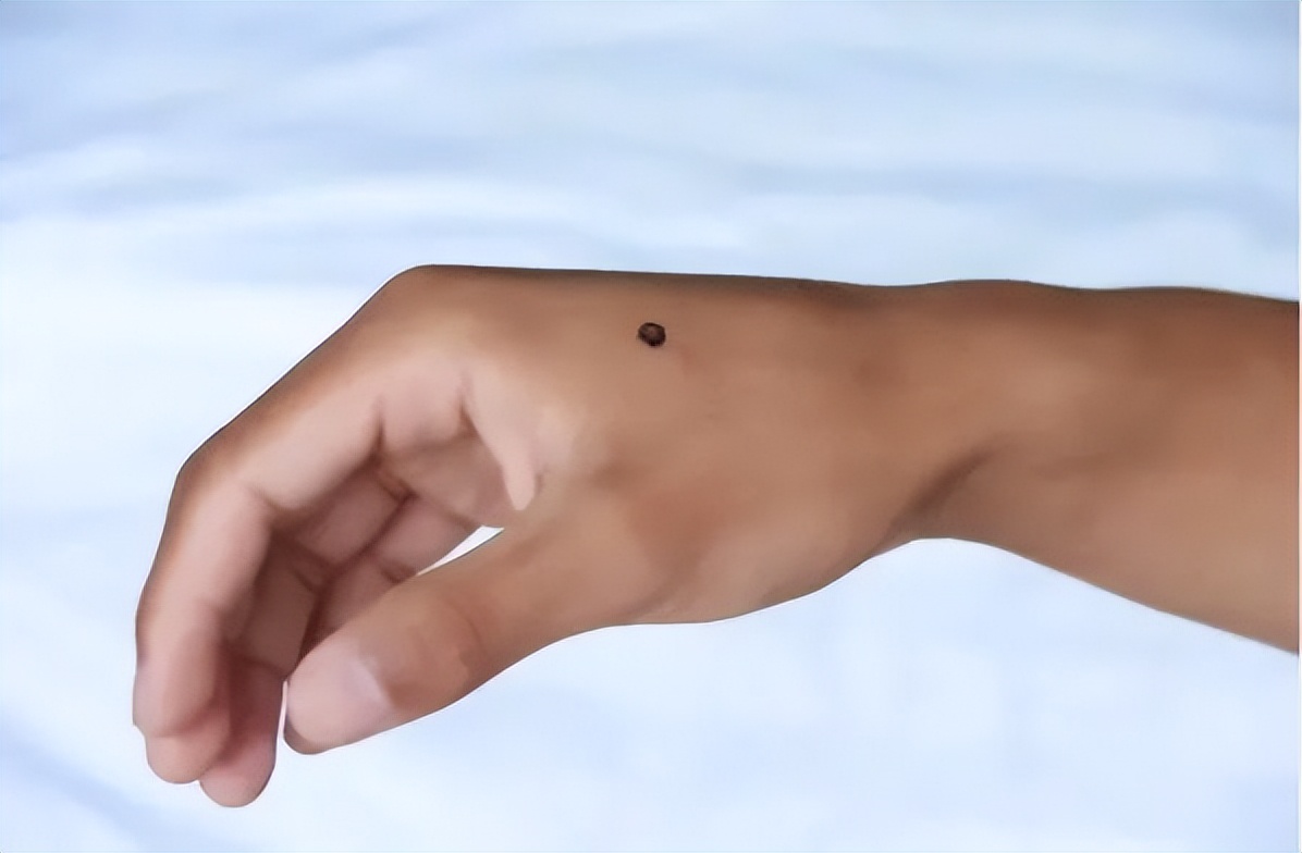 鼠标手手腕疼缓解方法,手握鼠标手麻了怎么办