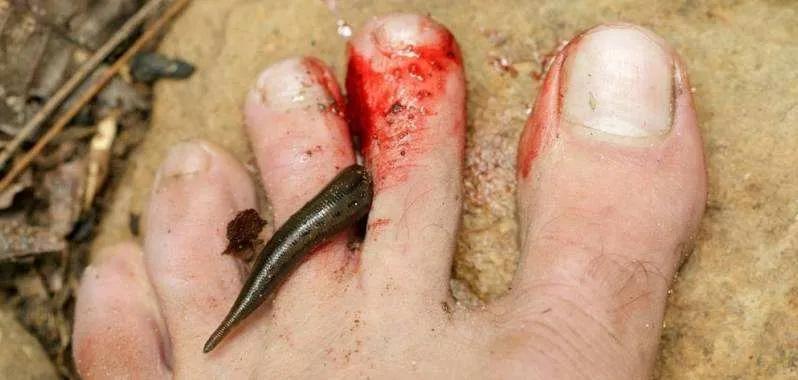 吸血鬼蚂蝗的视频,关于蚂蝗吸血鬼的小说