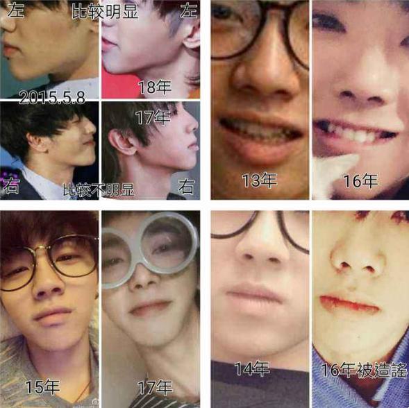 有一种倔强叫做没整容,有种倔强叫不承认整容