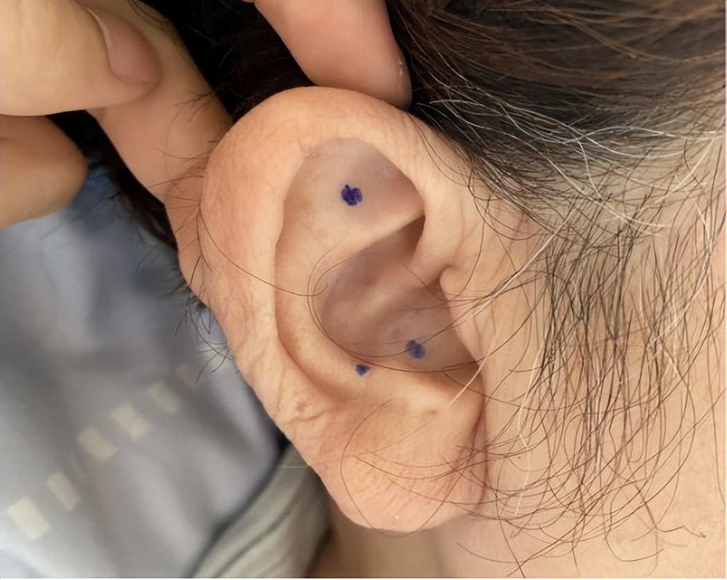 考前压力大睡不着怎么缓解,考前总是睡不着觉失眠怎么办