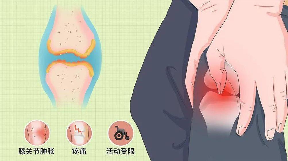 滑膜炎怎么恢复注意什么,滑膜炎怎样治疗才能快速恢复