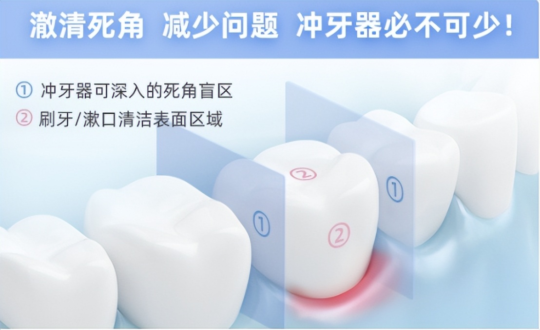 拜尔冲牙器评测推荐,冲牙器平价测评推荐