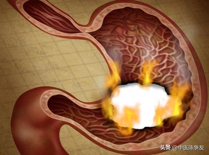 清降胃火中药,降胃火的小偏方