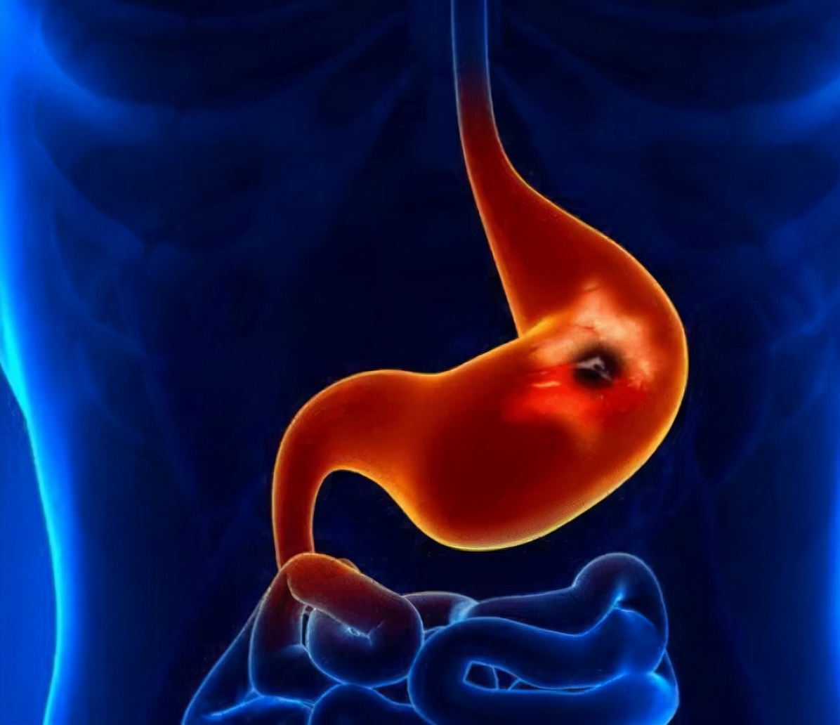 5种食物被誉为胃粘膜修复器,胃不好多吃这5种食物