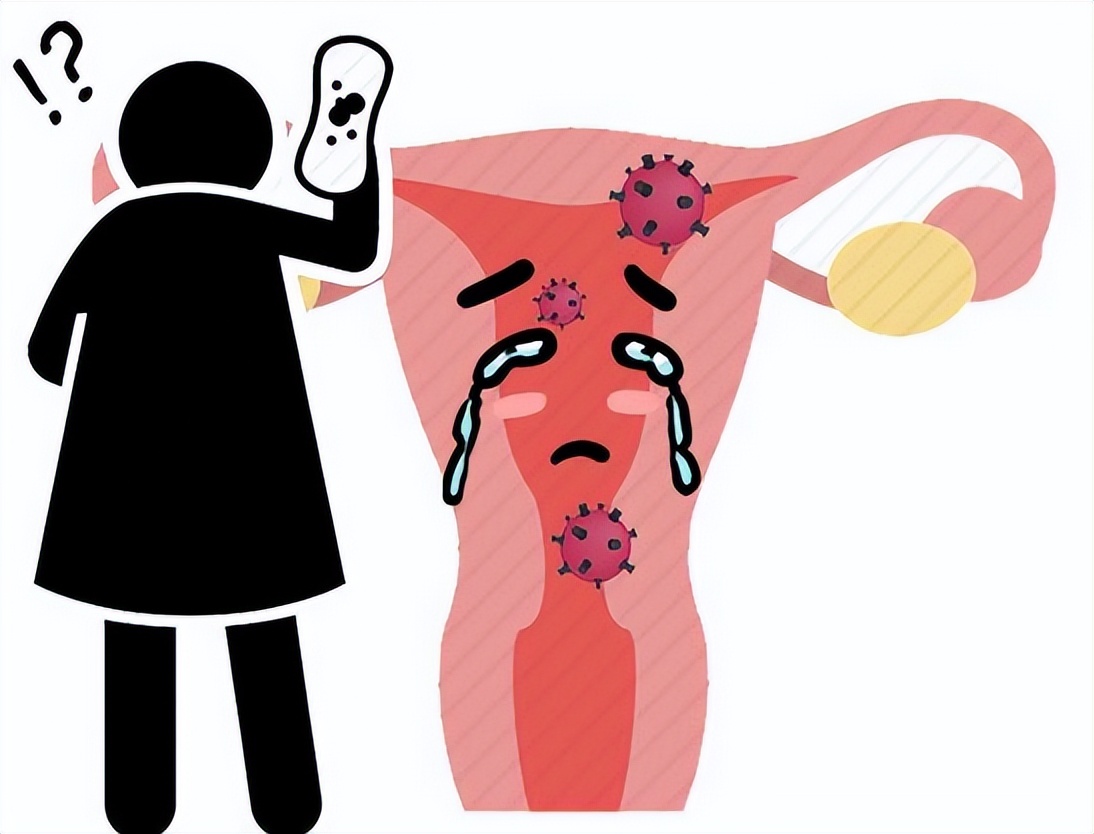 女性私部内瘙痒是什么原因,女性肛周瘙痒擦什么药最快最有效