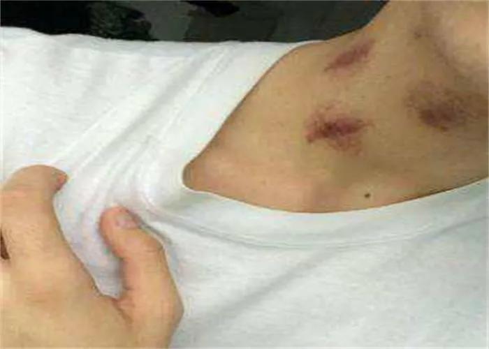 关于两性发文12:你有没有种草莓或被种草莓的经历？