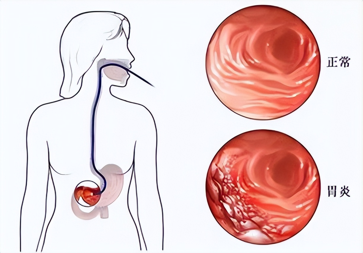 经常喝酒伤胃怎么调理,经常喝酒怎么防止身体受伤