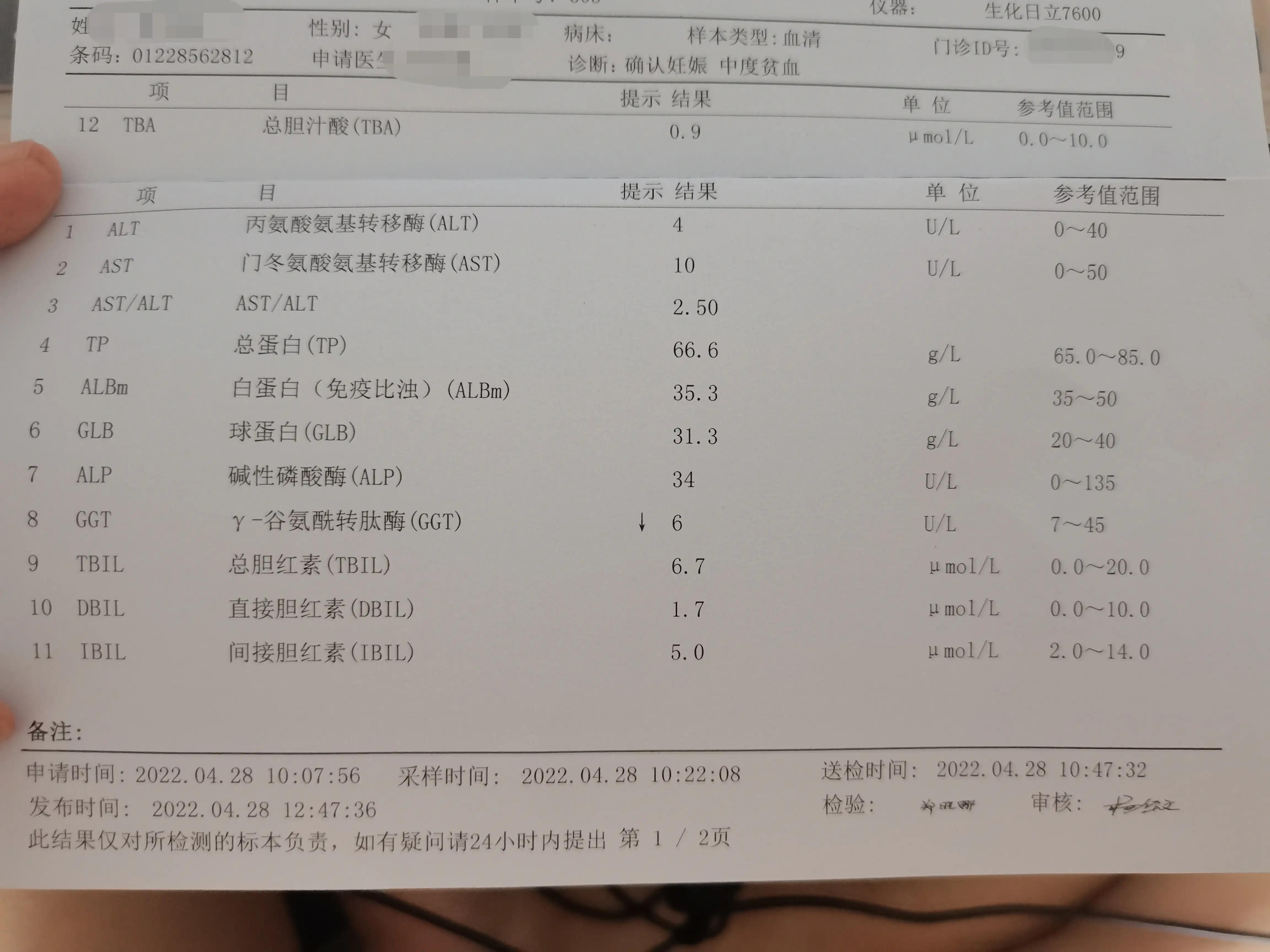 孕期湿疹对胎儿有没有影响,孕期手上长湿疹对胎儿有影响吗