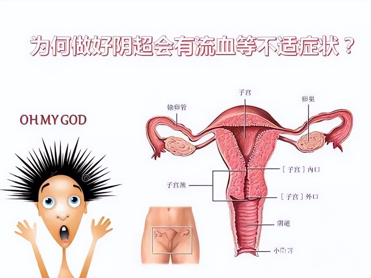 阴超到底有多疼,阴超到底有没有危害