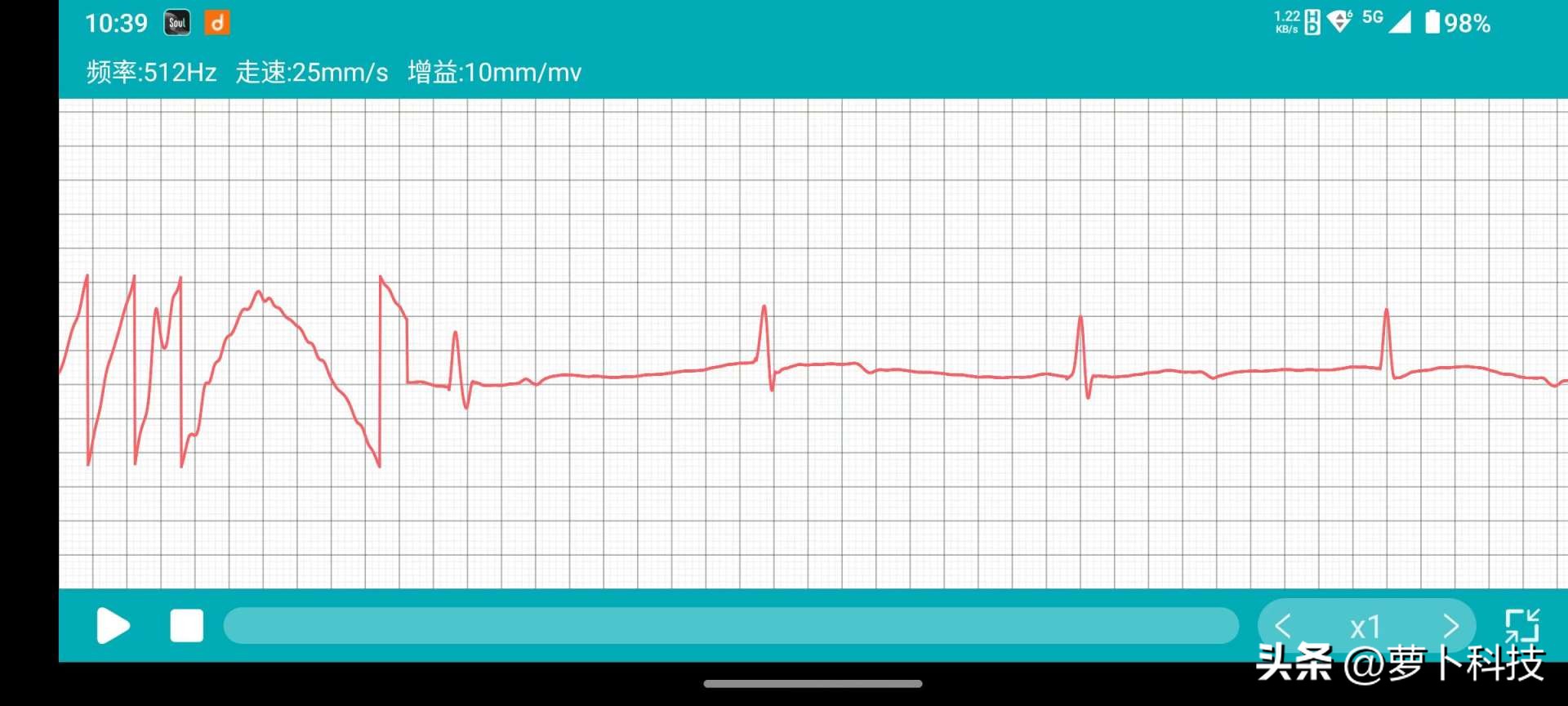 血压测压仪148元,血压血糖测试多少钱