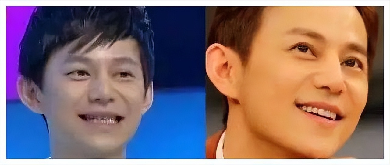 娱乐圈还有哪些假臀假肌肉,假臀假肌肉假肩膀的明星们