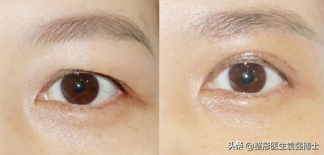 40岁以后要选择什么样的医美项目,40岁医美行业能干什么