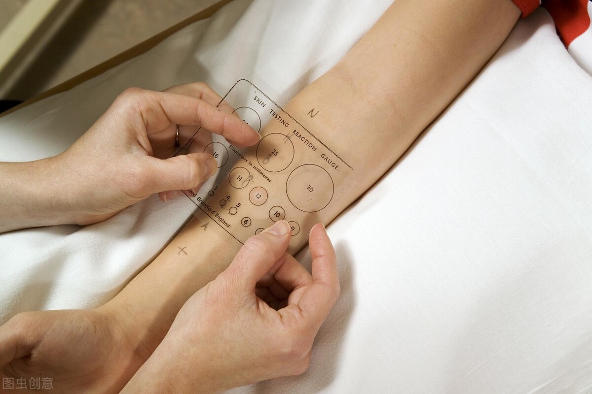 奇痒难耐,就连睡觉也不自觉地抓,怎么办?罗医生教你4招