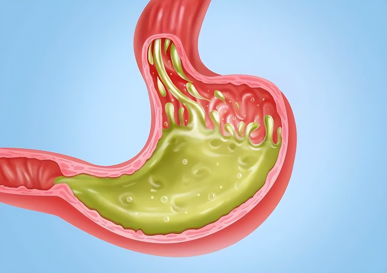 饭后经常反酸烧心是怎么回事,饭后感觉胃烧心平时怎么调理