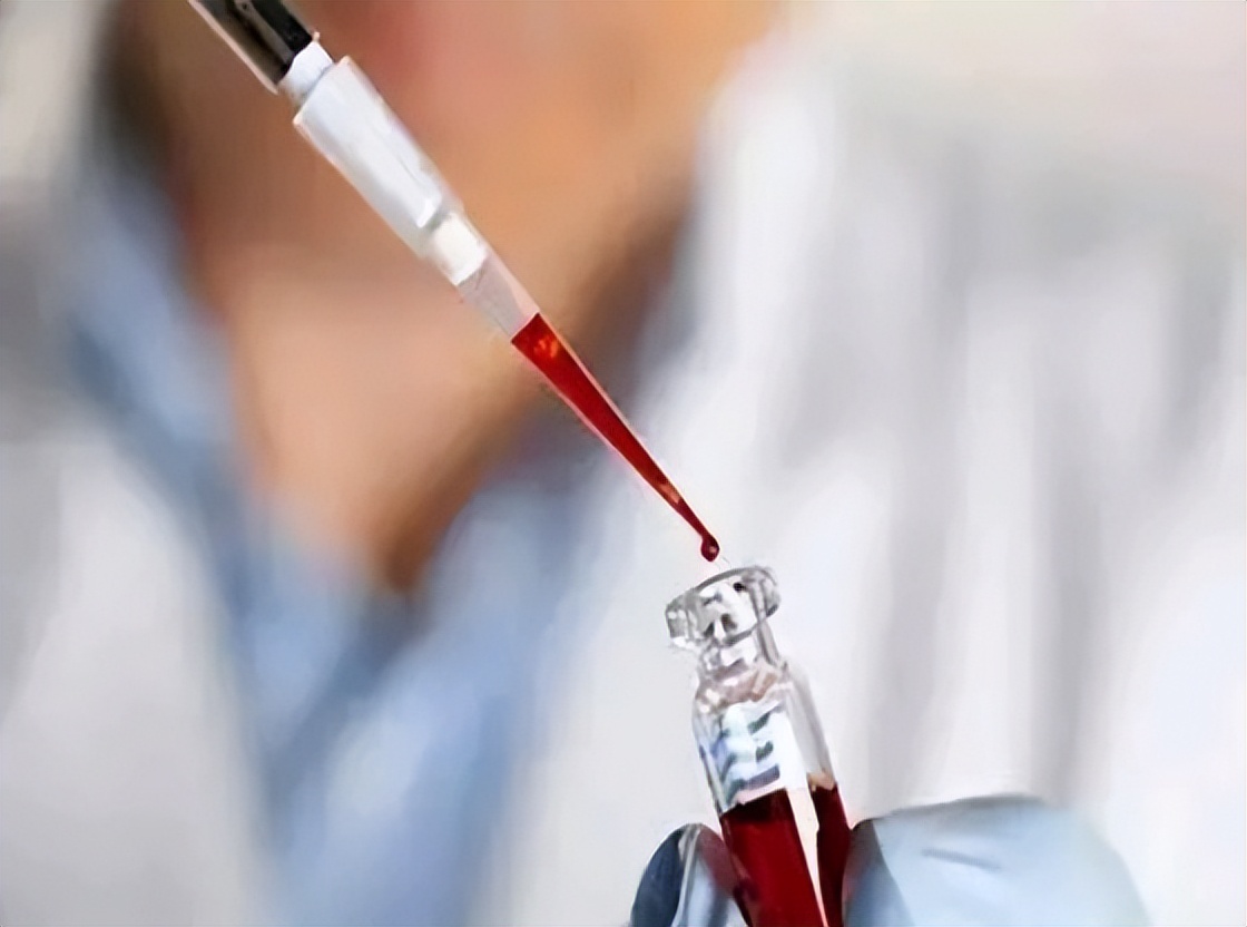 慢性炎症患者怎样预防癌变,慢性炎症诱发肿瘤