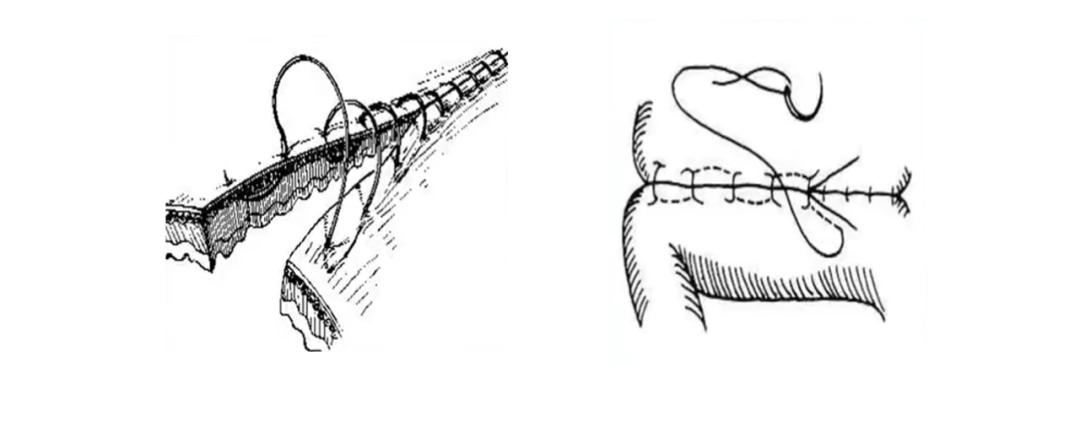 外科各种缝合方法的适用情况,外科操作缝合