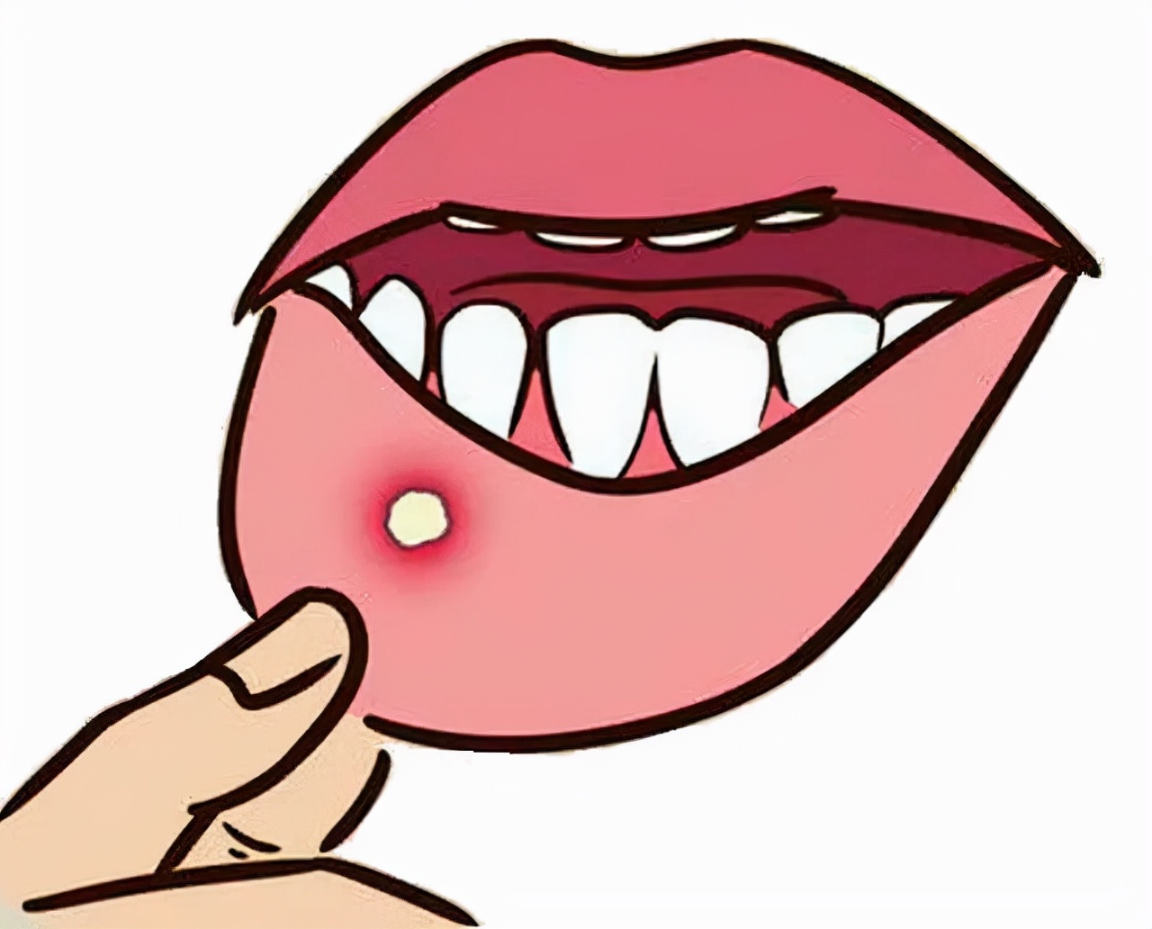 歪打正着的药物有哪些,歪打正着的药物汇总