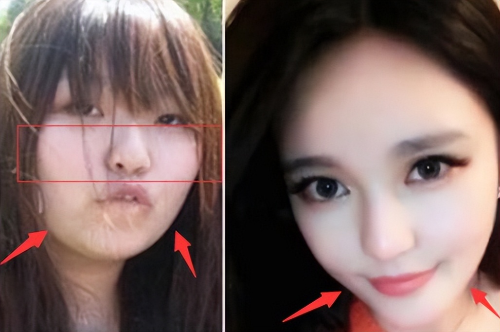 这些整容后都逆袭的女明星,盘点全网那些整容失败的女明星