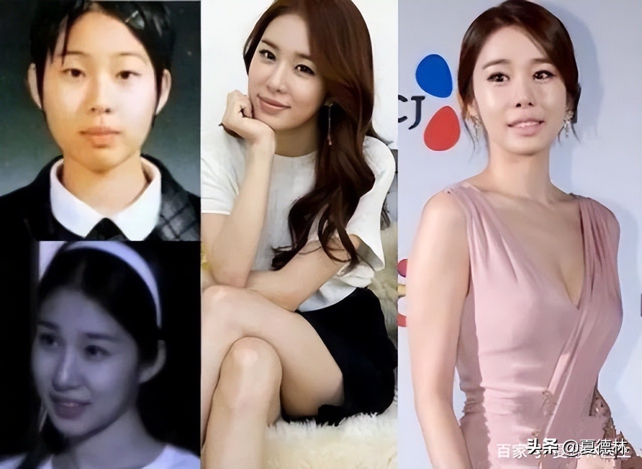 削骨和磨骨区别后遗症,削骨和磨骨的区别和危害