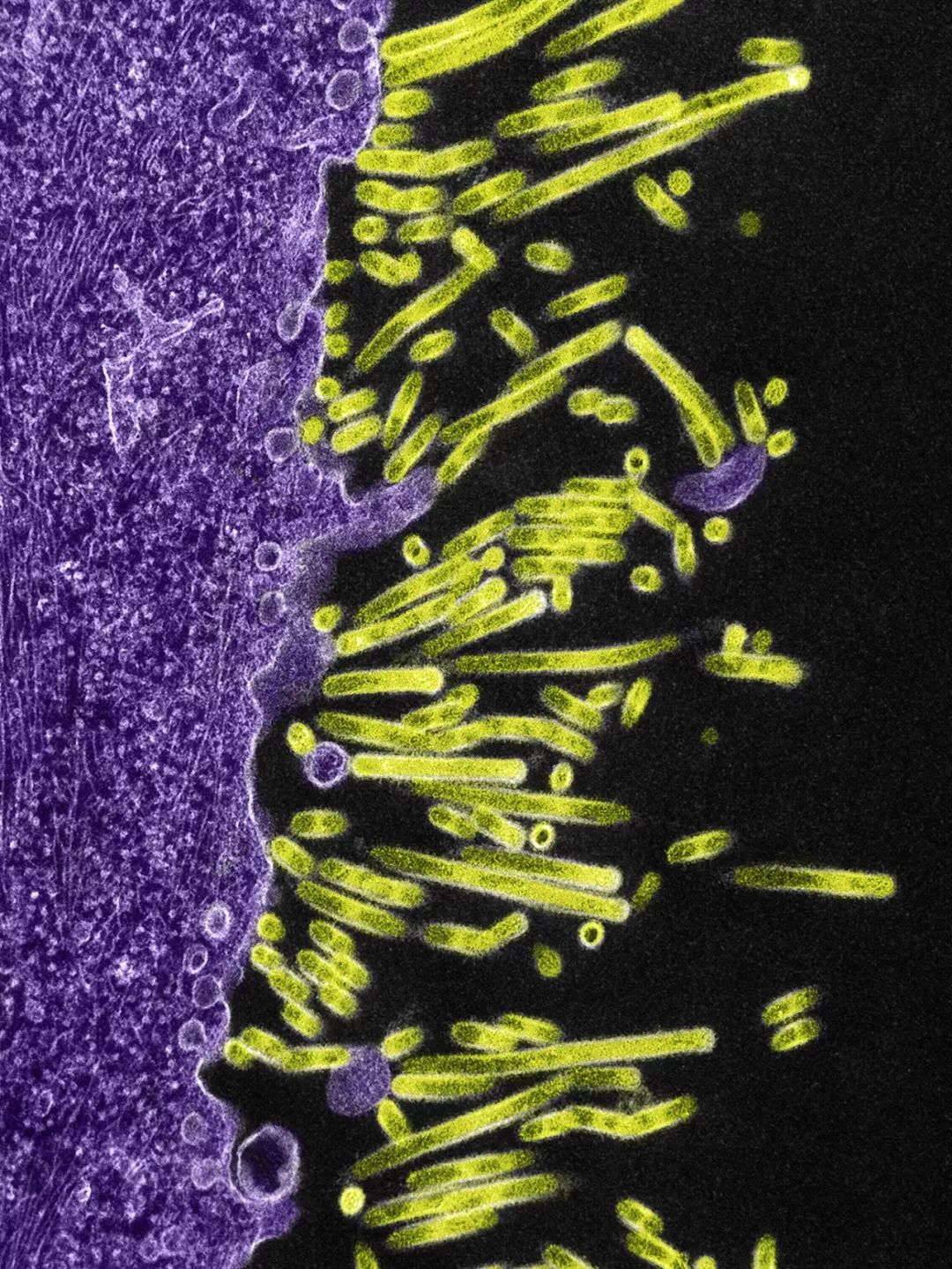 致与病毒搏斗的你！