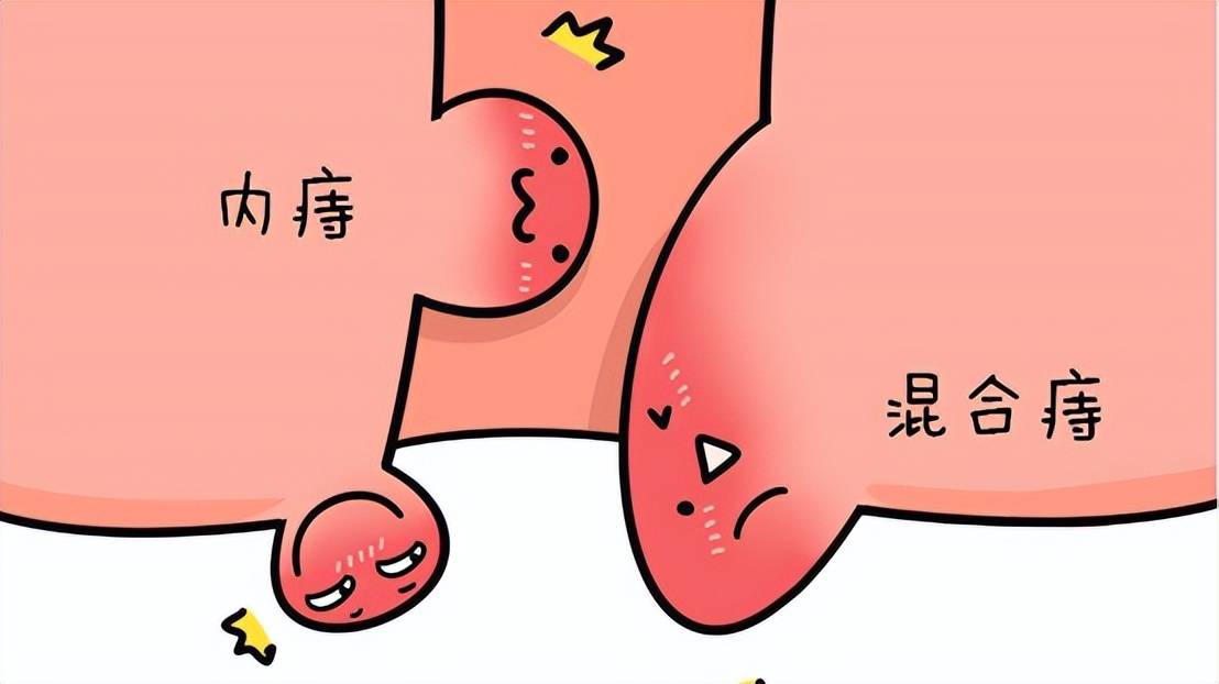 你有洗屁股的习惯吗,你有洗屁屁的习惯吗